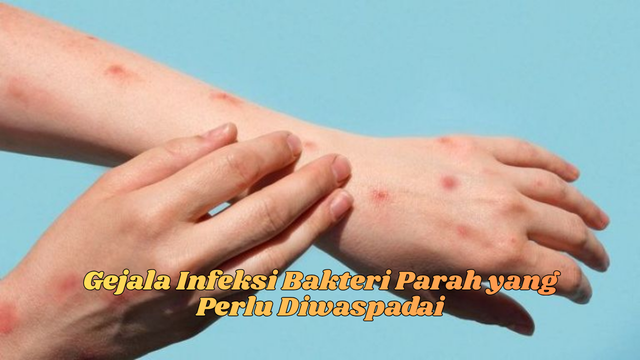 Gejala Infeksi Bakteri Parah