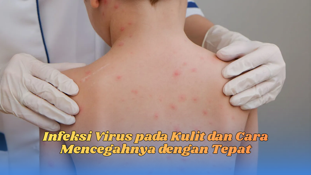 Infeksi virus pada kulit