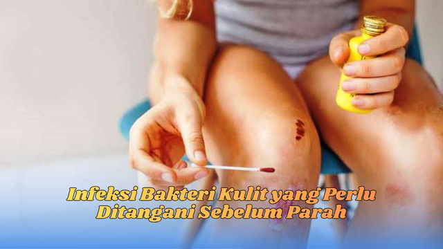 infeksi bakteri kulit