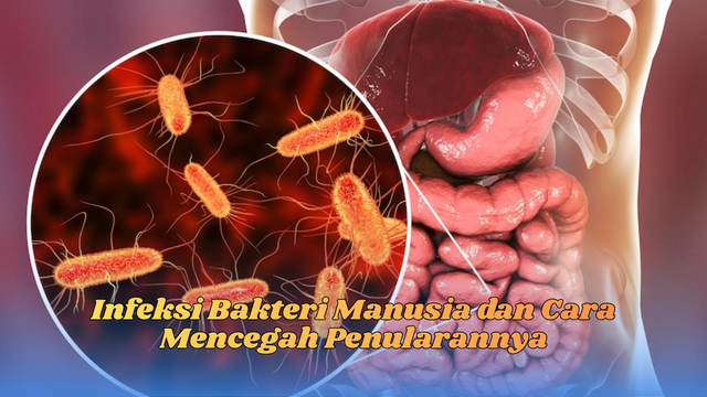 Infeksi Bakteri Manusia