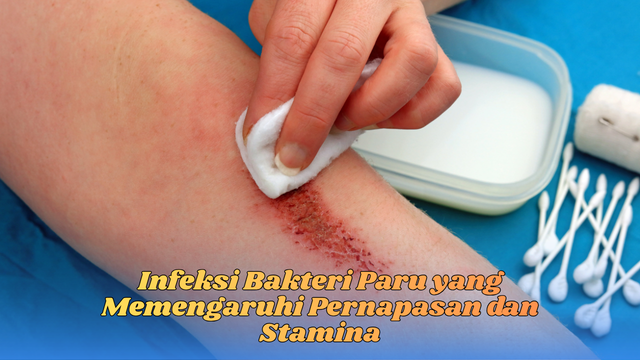 infeksi bakteri paru