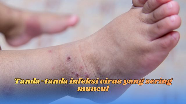 Tanda-tanda infeksi virus